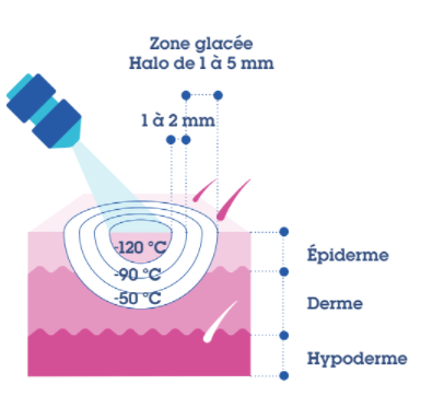 Dermatologie – Air liquide Santé France